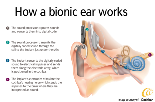 Bionic_Ear