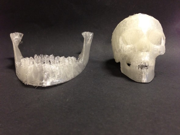 3d-printed-skull