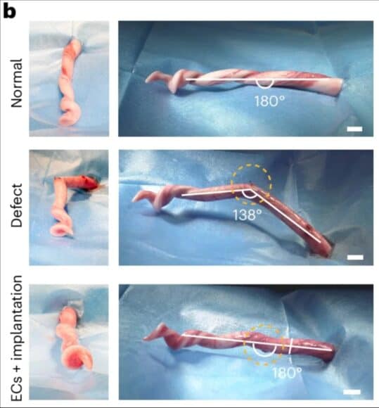 正常的豬陰莖；具有受損海綿體的陰莖；以及在移植兩週後，使用團隊植入物並融合內皮細胞修復的豬陰莖。